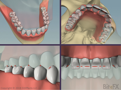 Ideal-Contacts-4-Views-400x299