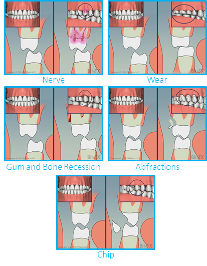 Molars-Guidance-Comparison-with-Insets-Individuals-Grouped